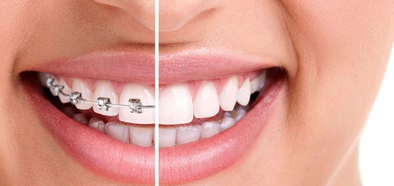 Orthodontics